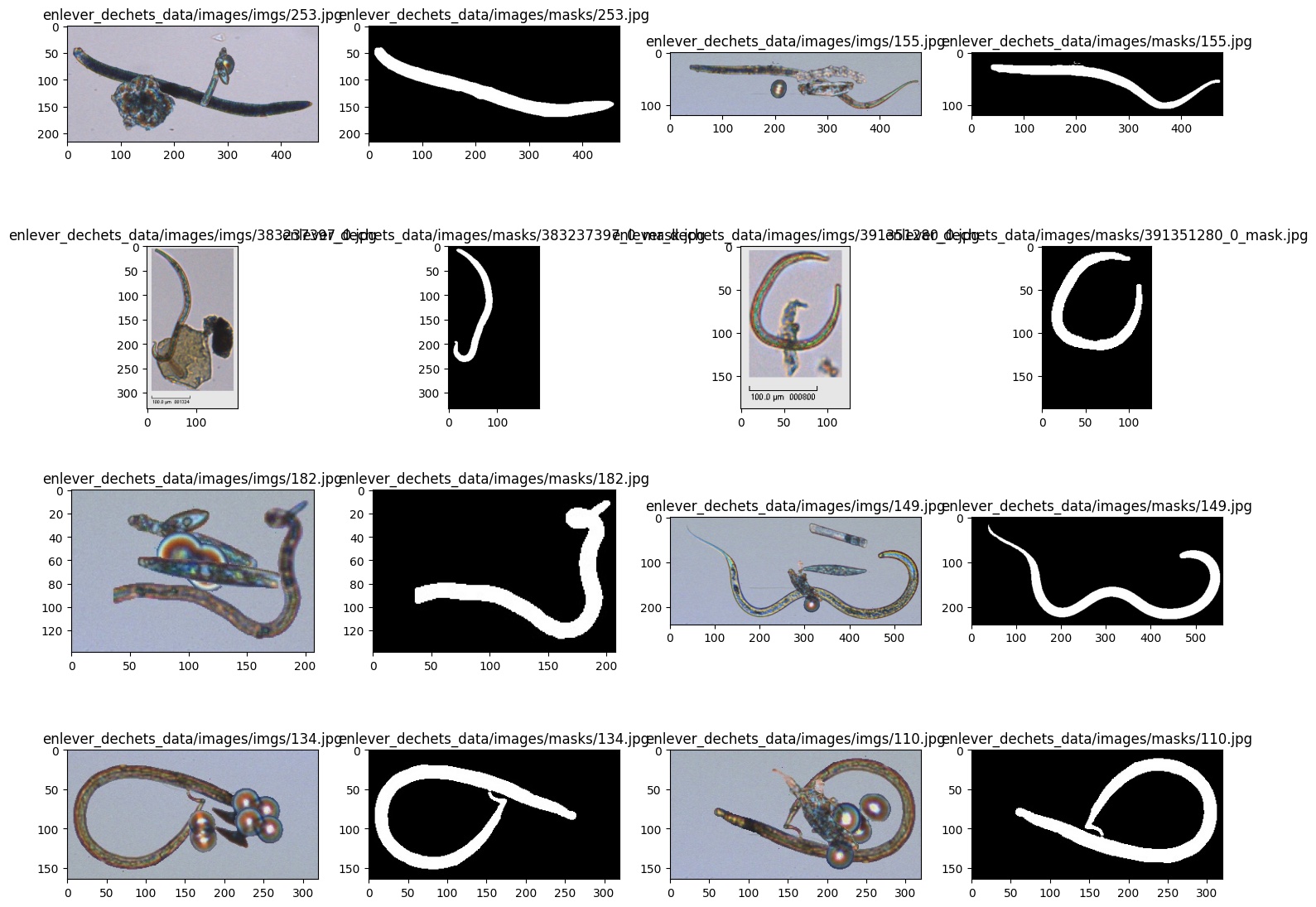 Imágenes reales de microscopio junto a sus máscaras binarias
